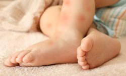 allergie per neonati